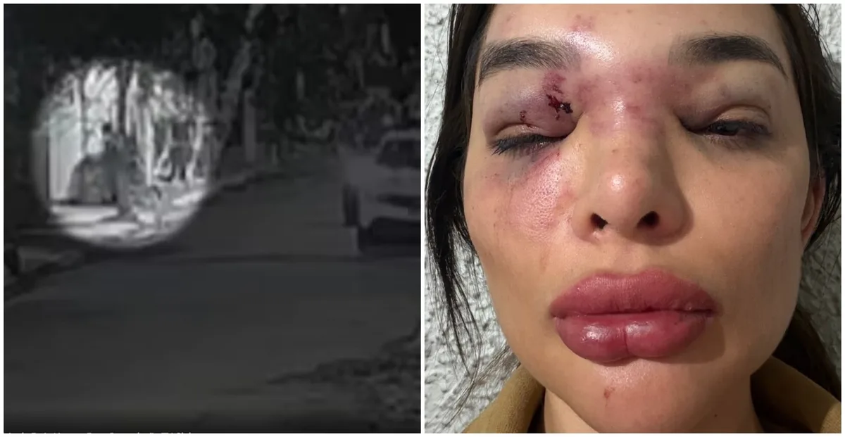 Polícia passa a investigar seguranças acusados de não ajudar mulher agredida pelo marido em frente de casa