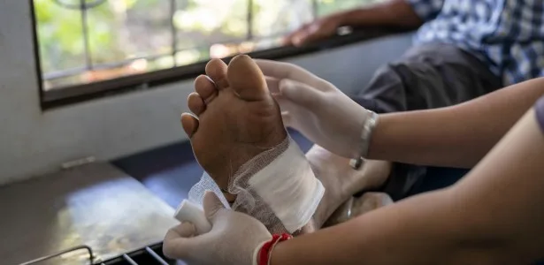 Nanopartícula combina duas estratégias para acelerar a cicatrização de feridas crônicas