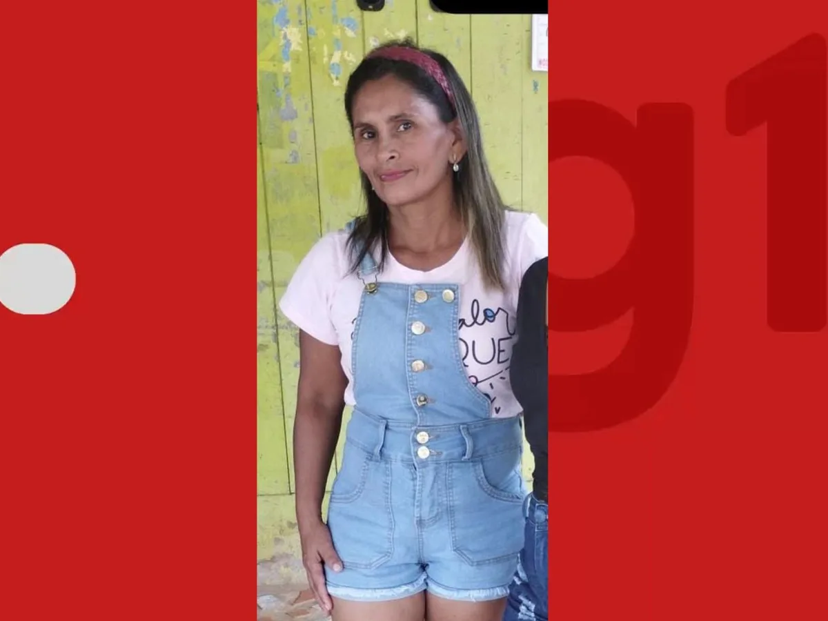 Zeladora que sofreu amputações após acidente no Acre tem alta e vai receber próteses