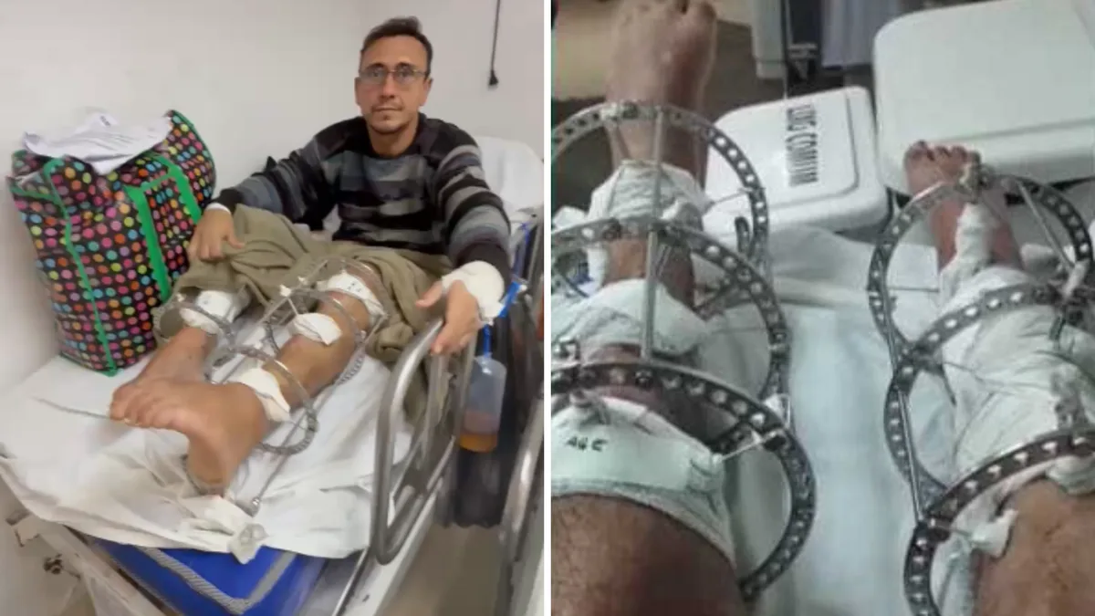 Paciente encontra larvas em ferida durante internação em hospital do Recife