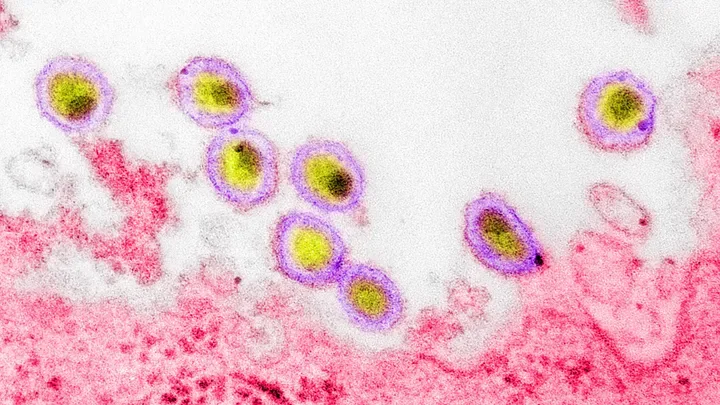 Les rumeurs qui ont changé le monde 2/10 : "Le virus du sida n'existe pas"