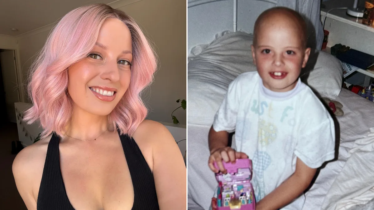 Alopecia advocate Holly Faller shares her 30-year journey to acceptance after wearing a wig since she was five