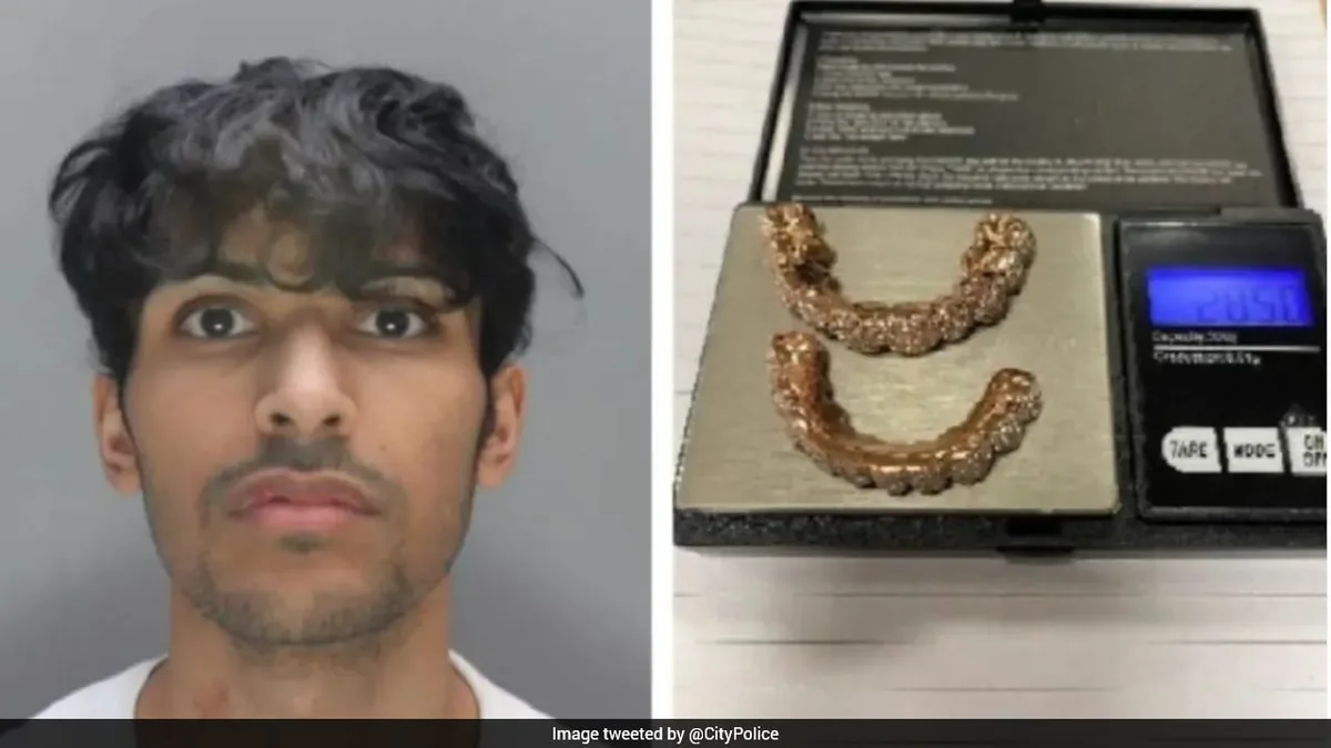 Gold Teeth, Luxury Flat, Dubai Trips: How UK Man Spent Money From Rs 2.56 Crore Crypto Theft