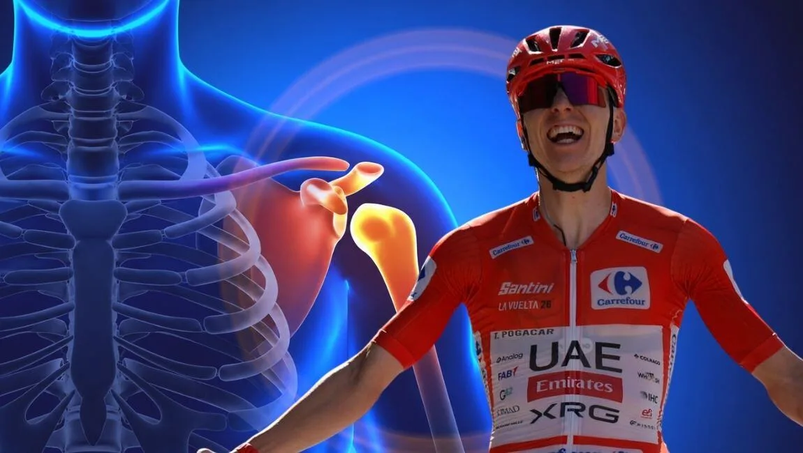 ¿Qué tan grave es la lesión de Tadej Pogačar? Así sería la recuperación del campeón del Tour de Francia