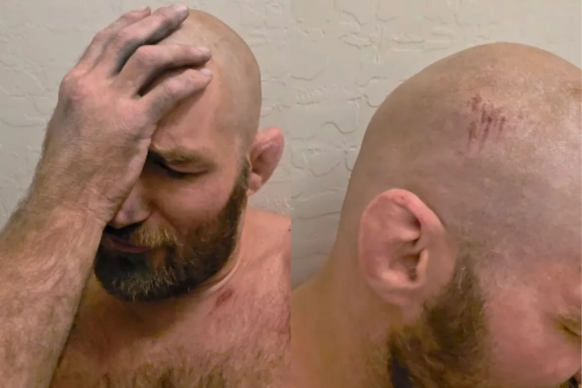 Campeão do UFC, Strickland é vítima de capotamento de carro e tem concussão