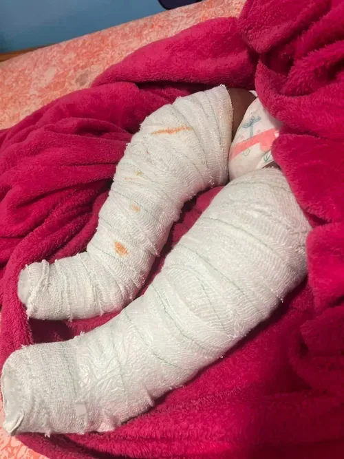 No arrests after 10-month-old baby’s legs broken in Saldanha assault