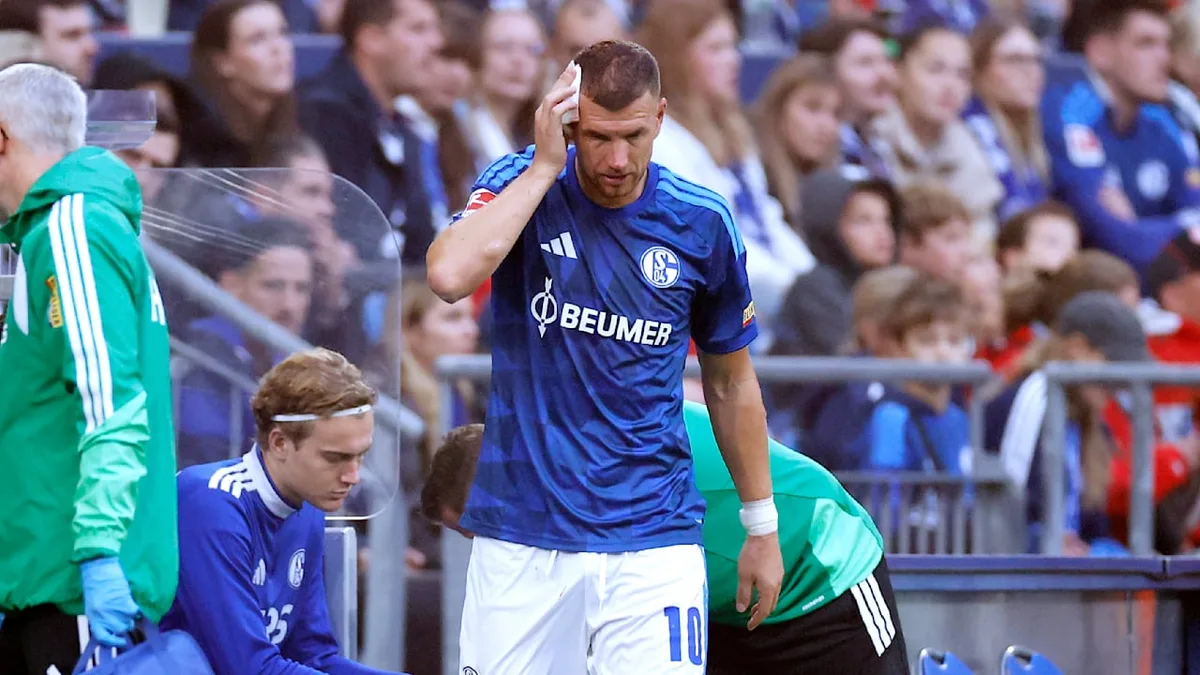 Schalke-Star muss raus - Blut-Schock um Dzeko