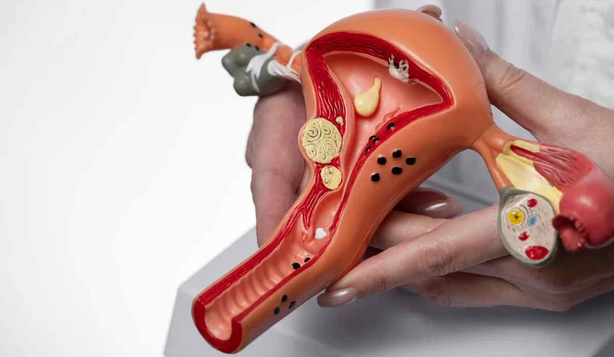 Microbioma endometrial: o que vive no útero pode influenciar as chances de gravidez