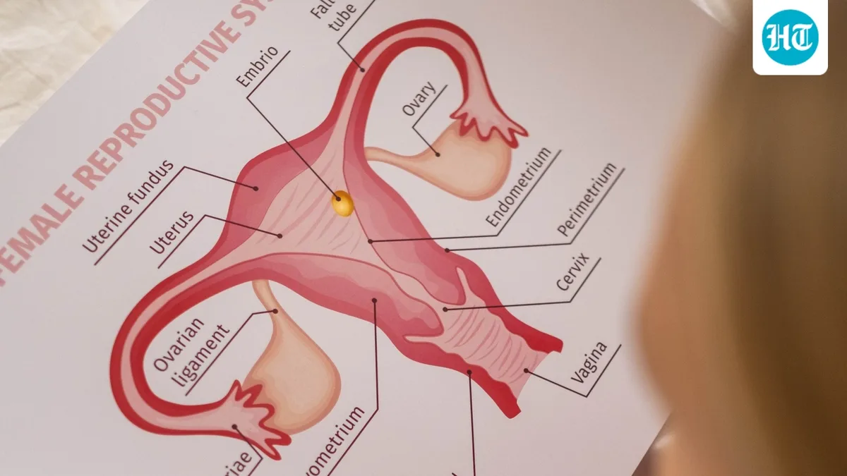 Have PCOS and trying to get pregnant? Here’s what you should know before considering IVF