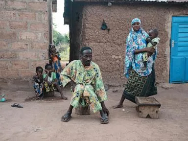 In Benin, malnutrition and misinformed views contribute to widespread stunting in children