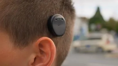 Cochlea-Implantat: Wie Hören wieder möglich wird