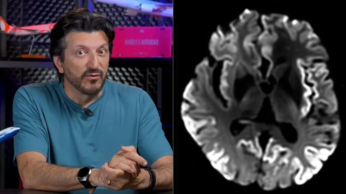 O que é Creutzfeldt-Jakob, doença sem tratamento diagnosticada em Lito Sousa que causa demência e perda progressiva dos movimentos