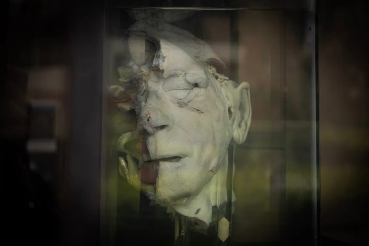 El “hombre de dos cabezas” y otras historias impactantes detrás de las piezas del Museo del Cerebro de Lima, único en Latinoamérica