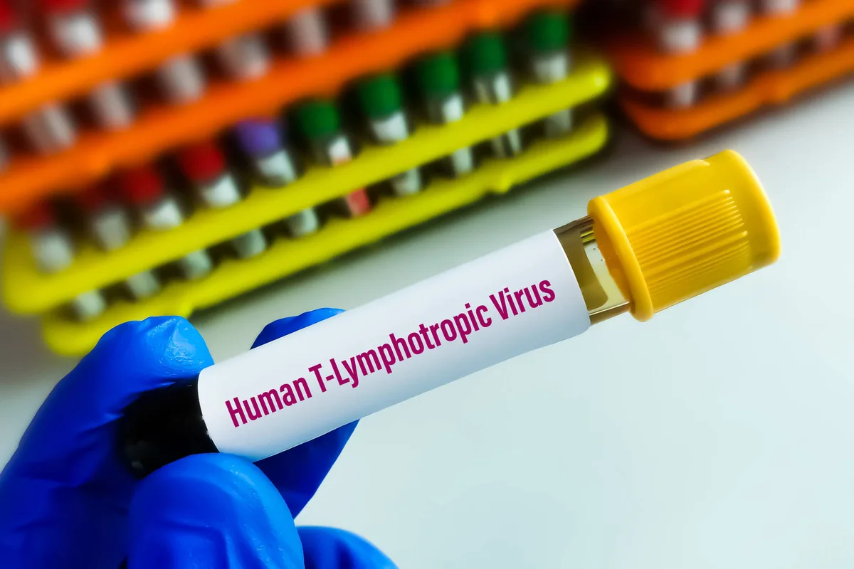 Vírus HTLV-1 causa síndrome inflamatória em assintomáticos, aponta estudo