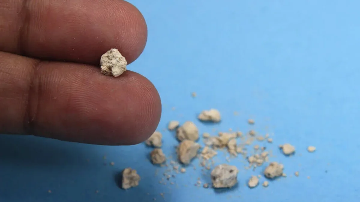 La infusión de hierbas naturales que ayuda a filtrar los riñones y prevenir la formación de cálculos