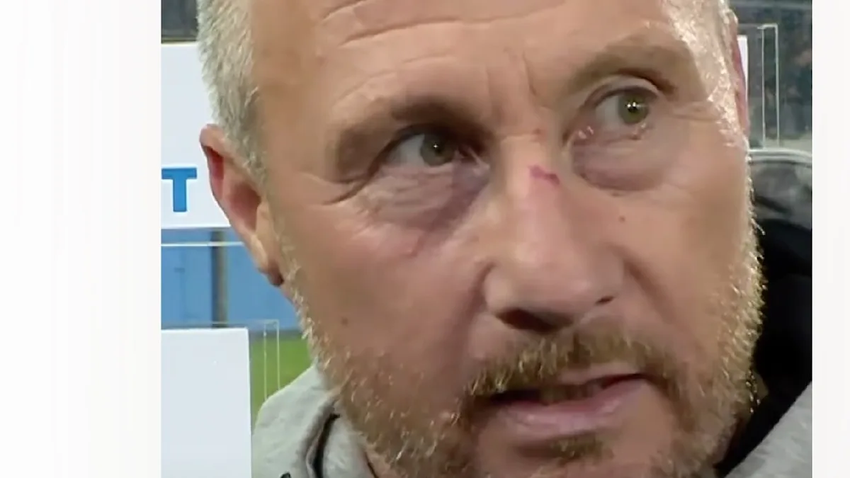 Skandal im Derby - Kind wirft Österreich-Trainer Becher ins Gesicht