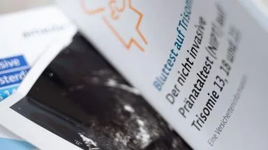Bundestag will Trisomie-Test besser überwachen
