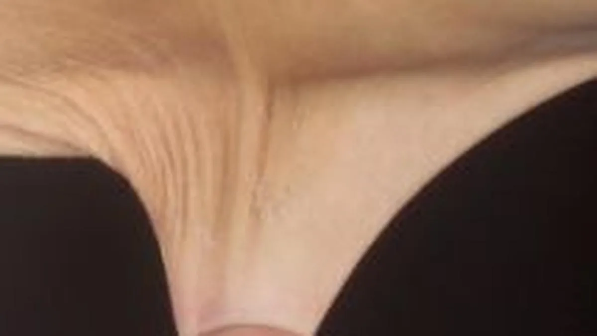 All you need to know about: Ehlers-Danlos Syndrome