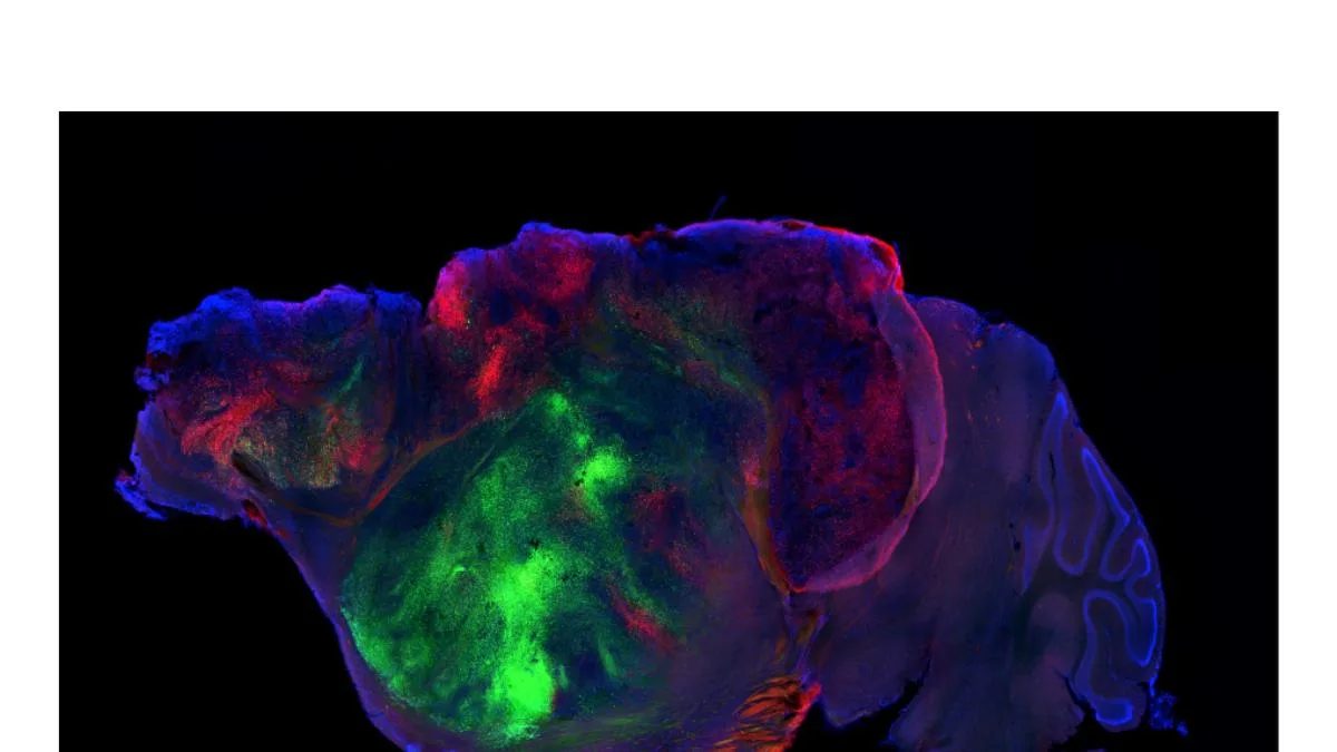 Organoides de cerebros humanos crecen en ratones para estudiar trastornos neurológicos