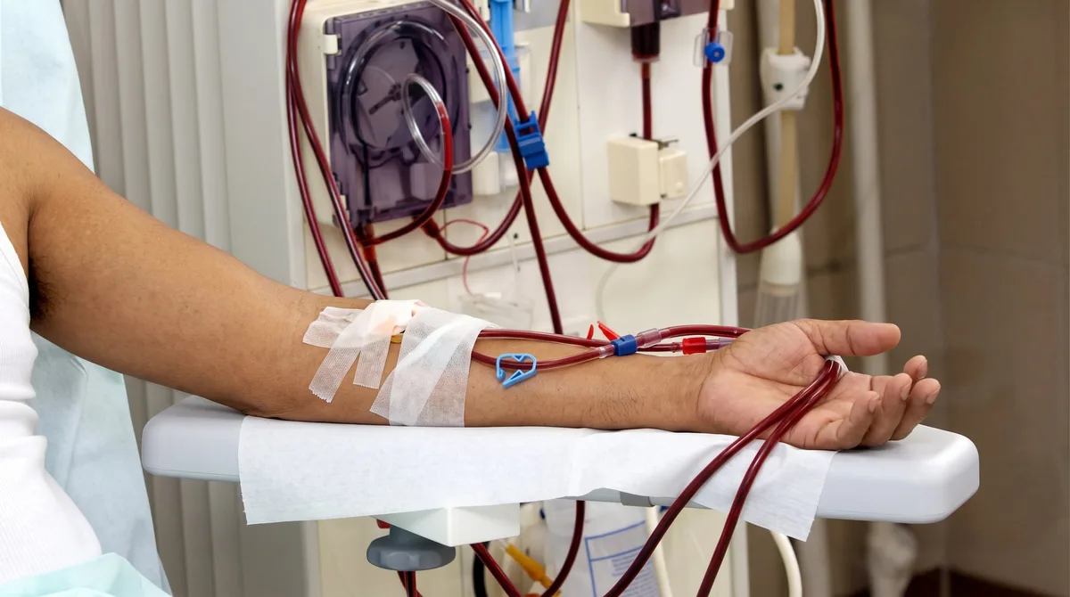 Seguro Social reporta un aumento anual de 100 pacientes con enfermedad renal crónica en El Salvador
