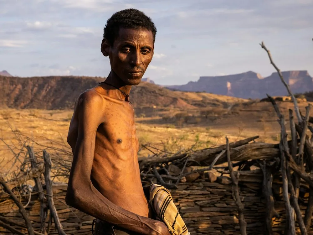 Welternährung: Der Hunger kehrt zurück