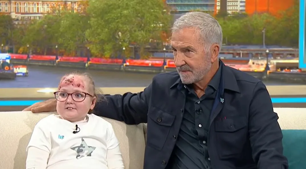 Tiene 14 años, tarda 5 horas en curar sus heridas y un jubilado caminó 161 kilómetros para visibilizar su enfermedad: Poppy y su lucha contra la piel de mariposa