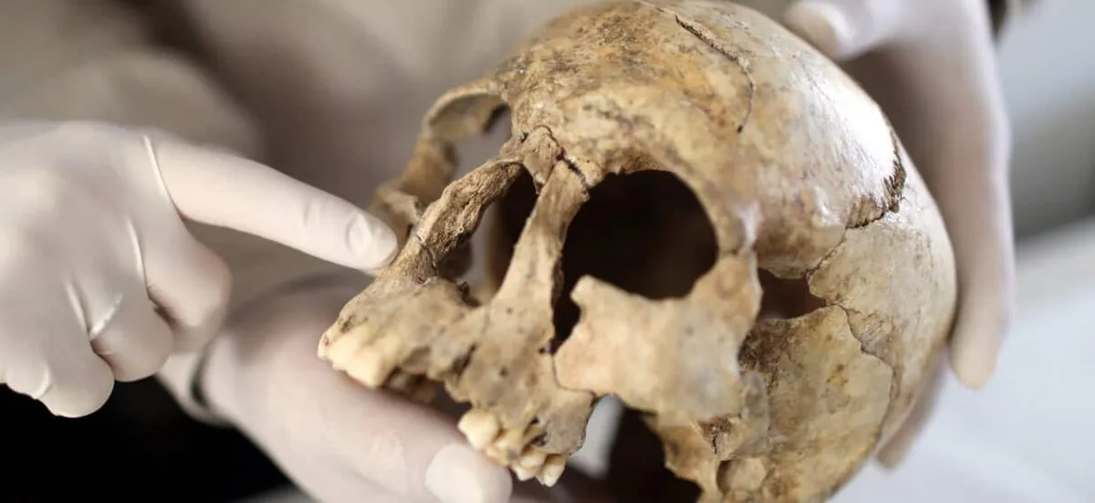 How ancient teeth are changing what we know about early drug use