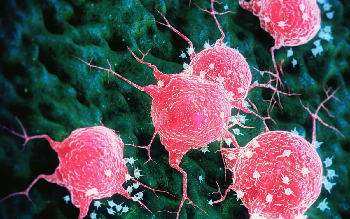 Cancer : ce médicament vieux de 100 ans ouvre une piste inattendue contre les métastases
