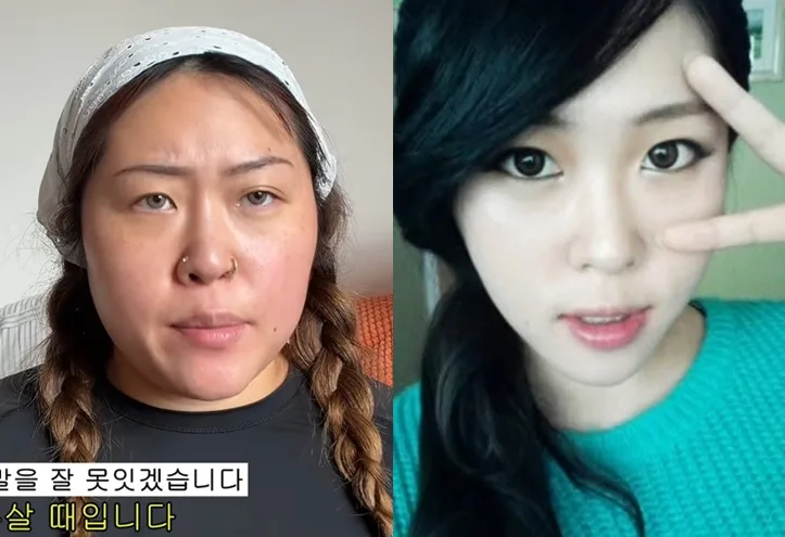 “백진경 맞아?” 20kg 감량 모습 화제… 운동 없이 살 뺀 방법은?