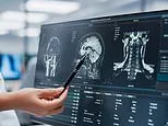 Experts raise alarm over concerning rise of deadly brain-liquefying fungus