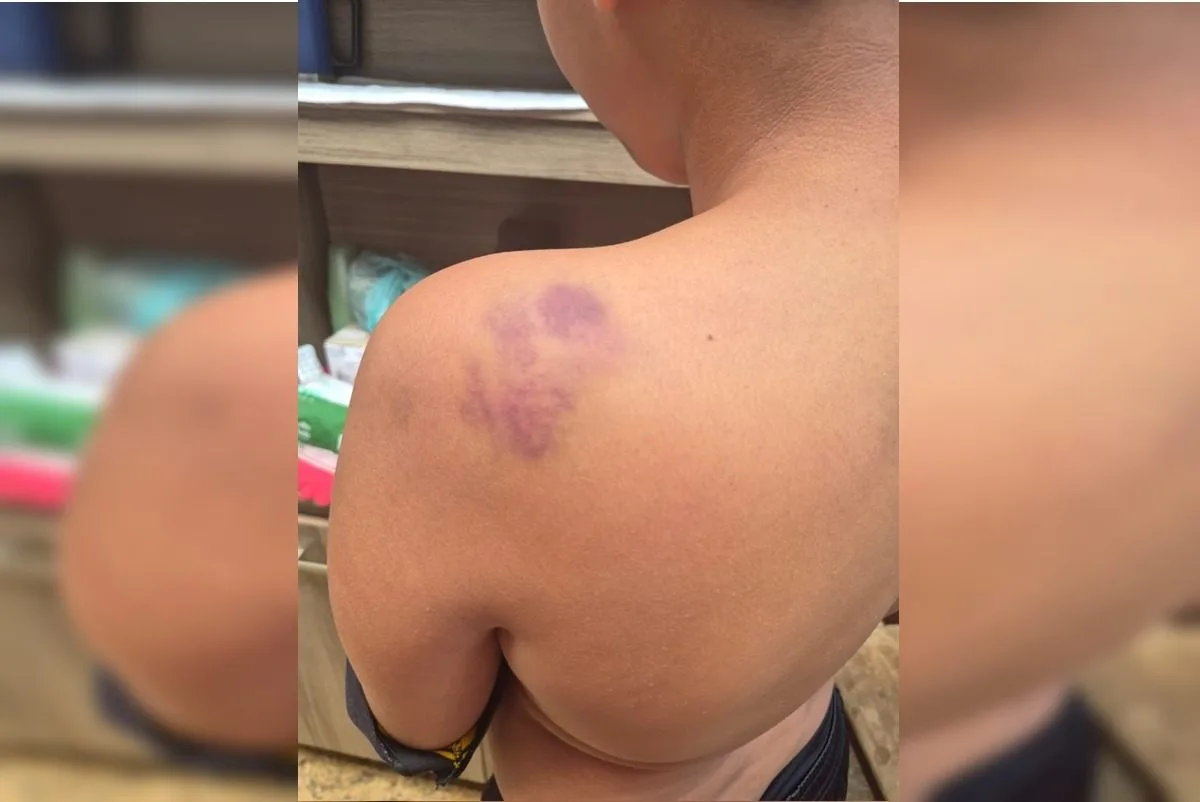 Aluno de 12 anos é espancado após ser xingado de "neguinho" em escola do DF