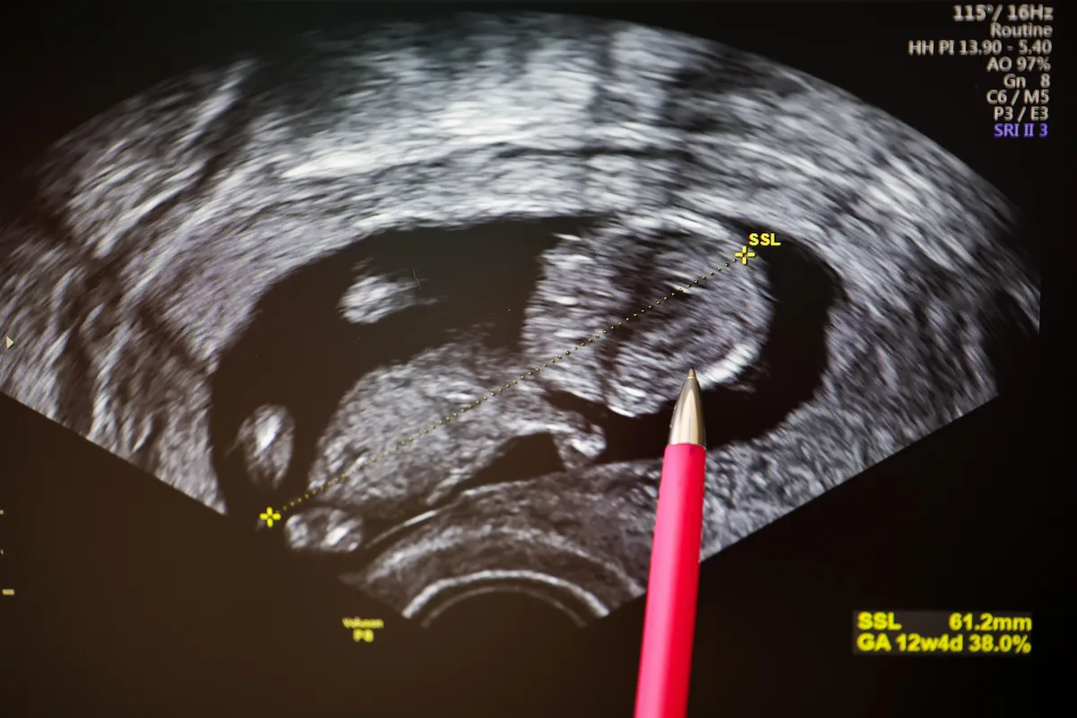 The dark side of optimizing fertility