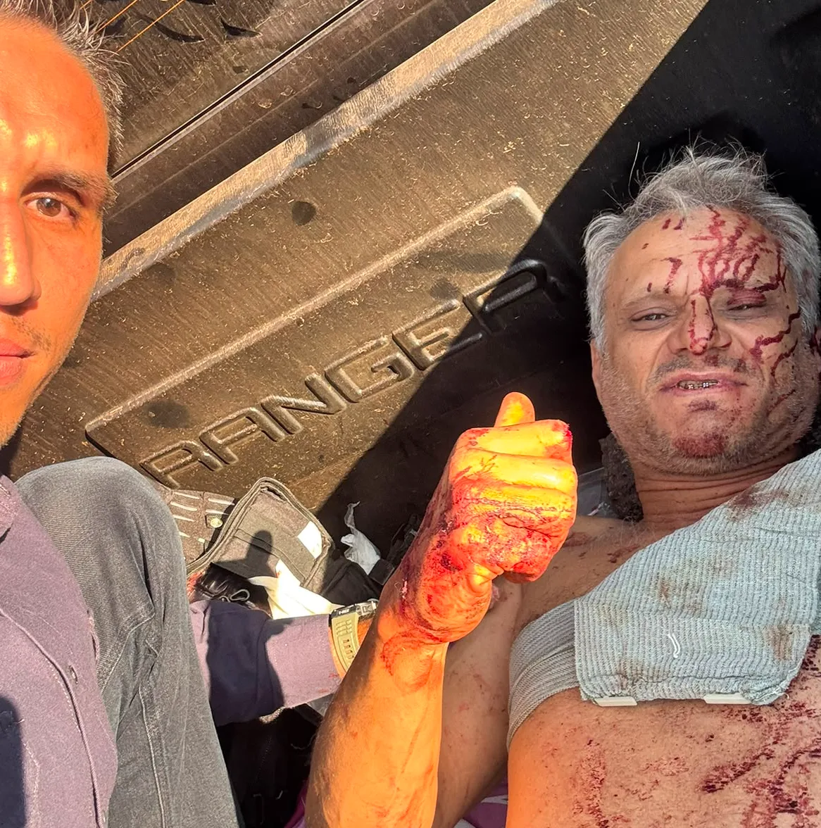 “Nunca vi nada igual”, diz policial que encarou chamas para salvar motorista