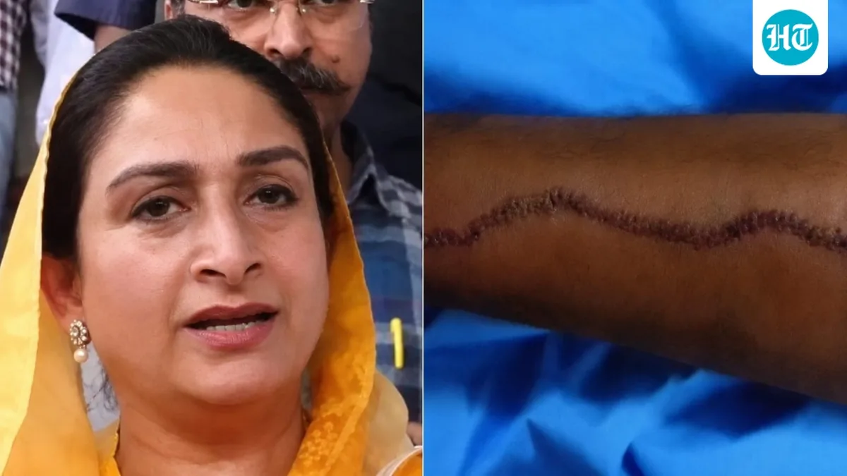 SAD's Harsimrat shows weapon used in Nanded attack on Sukhbir Singh Badal, stitches on his arm