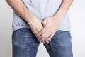 Una pequeña herida en el glande que no cicatriza puede ser el primer signo de un carcinoma de pene, según un experto