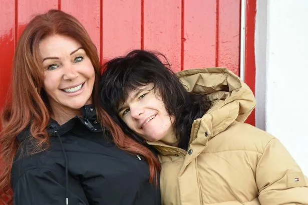 Billy Caldwell turns 21 - the boy who legalised medicinal cannabis in Britain