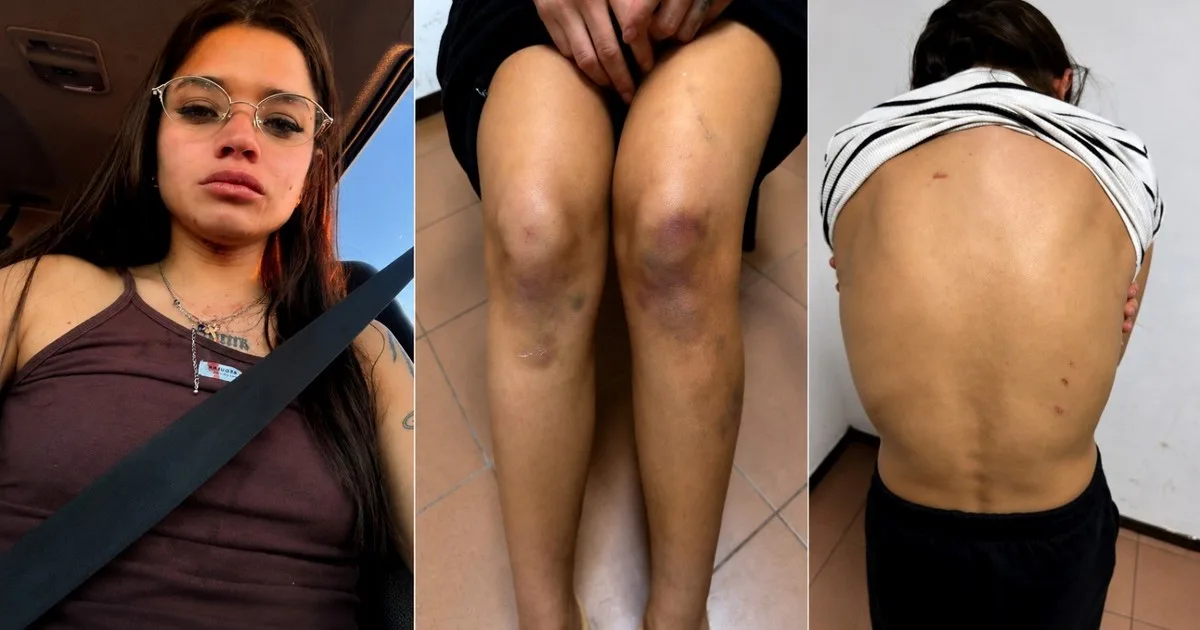 Qué dice el informe sobre las lesiones de Julita Cantero, la joven detenida por matar a su novio en Chaco