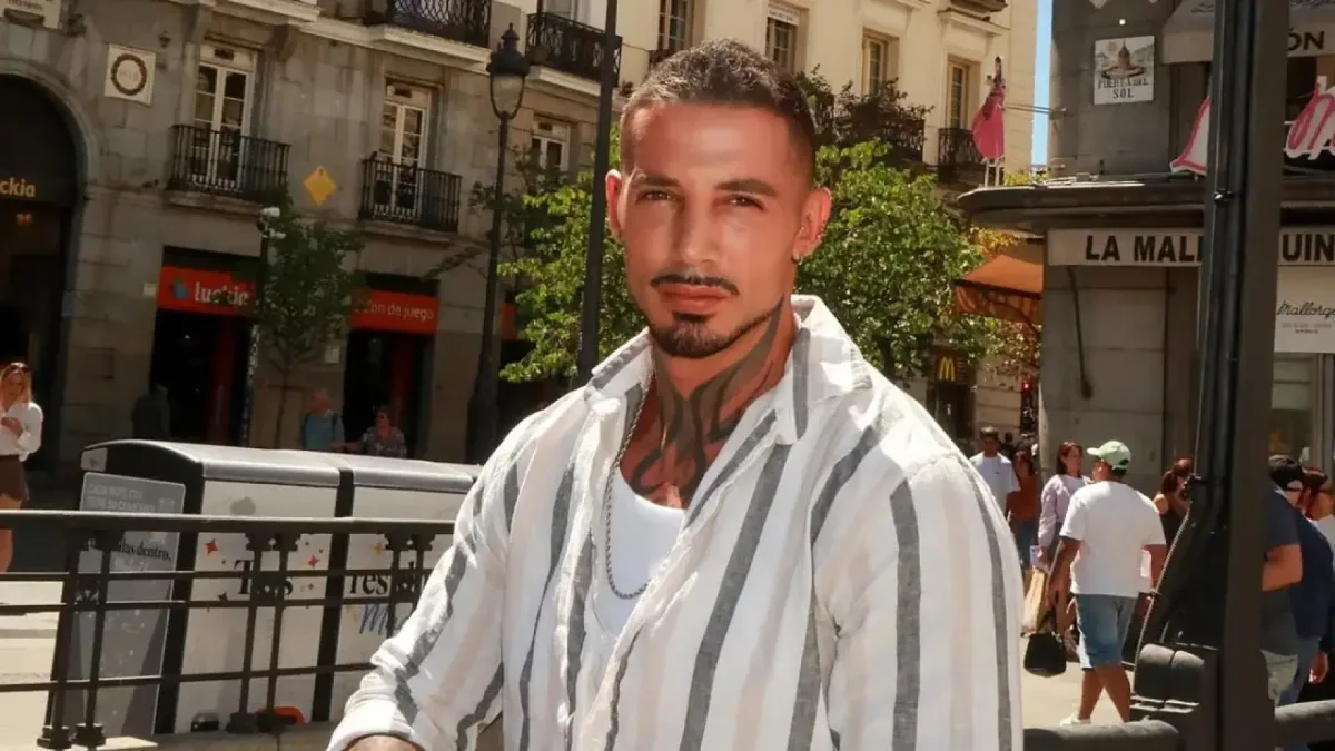 José, de 'La isla de las tentaciones 10', enseña su nueva nariz y las redes responden: "Estabas más guapo antes"