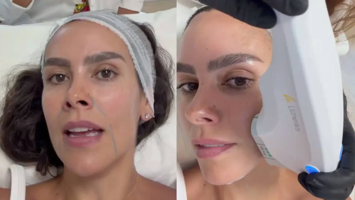 Cristina Pedroche se somete a un tratamiento para la flacidez de la cara: "Primera vez que me hago una cosa así"