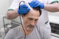 Por que a depilação a laser não funciona bem em pelos loiros?