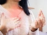The hidden dangers of omeprazole: It is lauded as the ultimate solution to crippling acid reflux which affects millions - but as DR SCURR reveals, using it long term can have serious implications