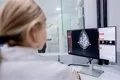 Un fármaco para suprimir la lactancia tras parto podría reducir el riesgo de cáncer de mama, según estudio internacional