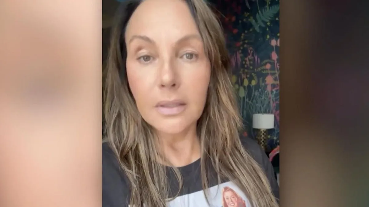 „Ballonkopf ist weg“: Natascha Ochsenknecht zeigt stolz Ergebnis ihrer Schönheits-OP