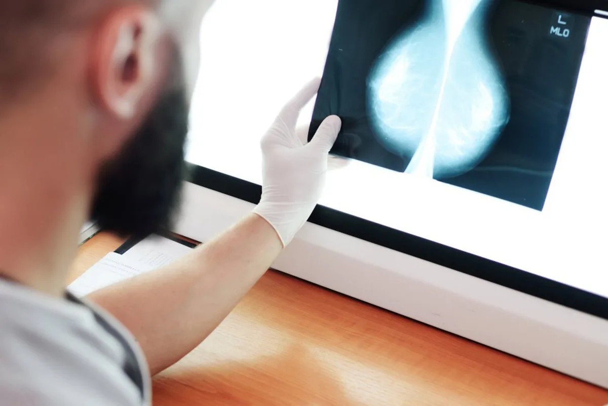 El Tribunal Superior confirma la incapacidad permanente total para una auxiliar de comedor por las secuelas de un cáncer de mama