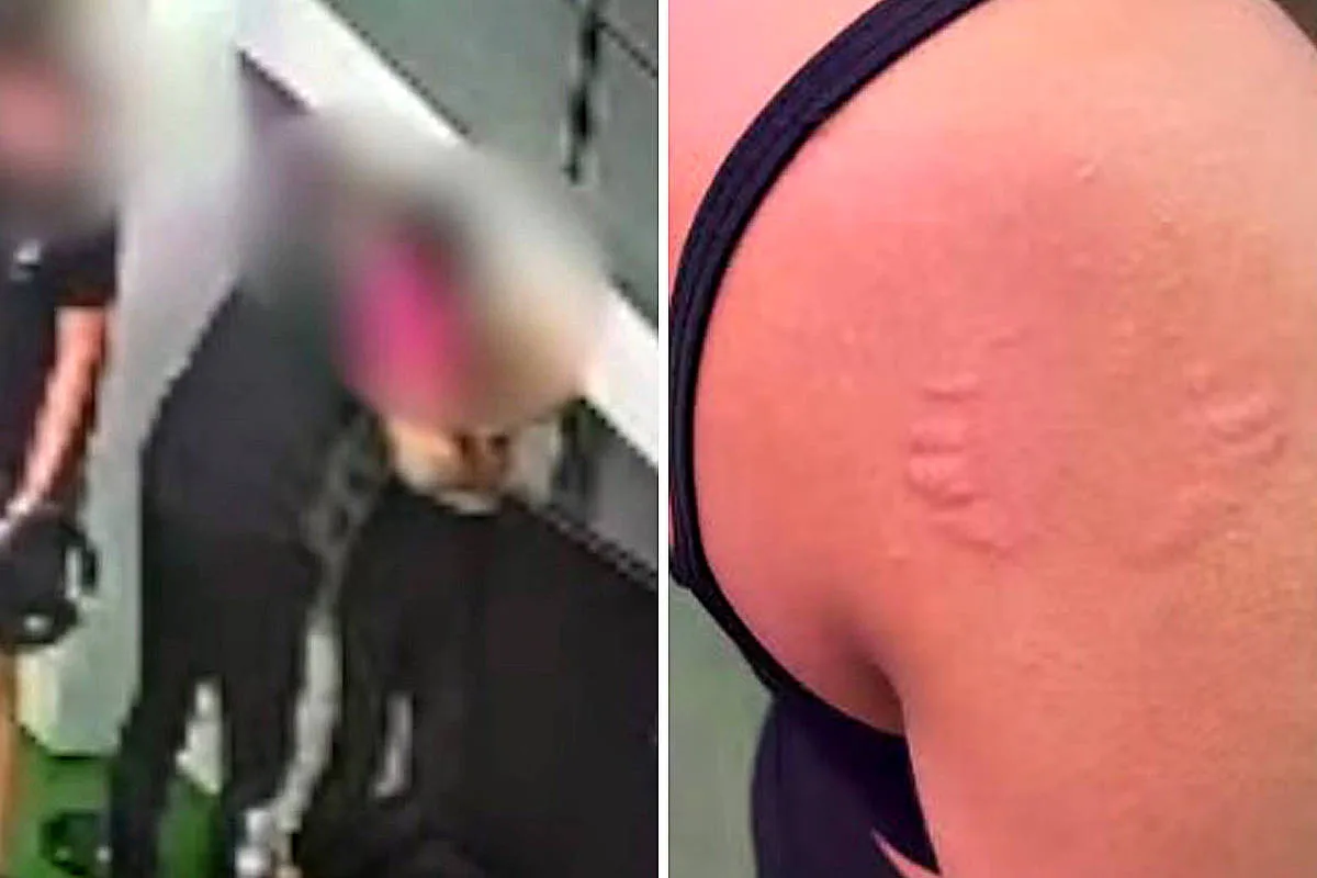Mulher denuncia assédio após ser mordida por instrutor em academia no Recife