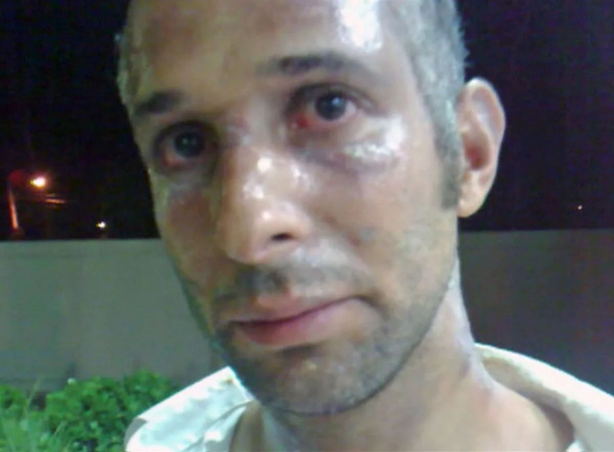 Queimaduras por todo o corpo, inseticida na cara e 20 horas de pânico: o relato do ex de Veronica Costa
