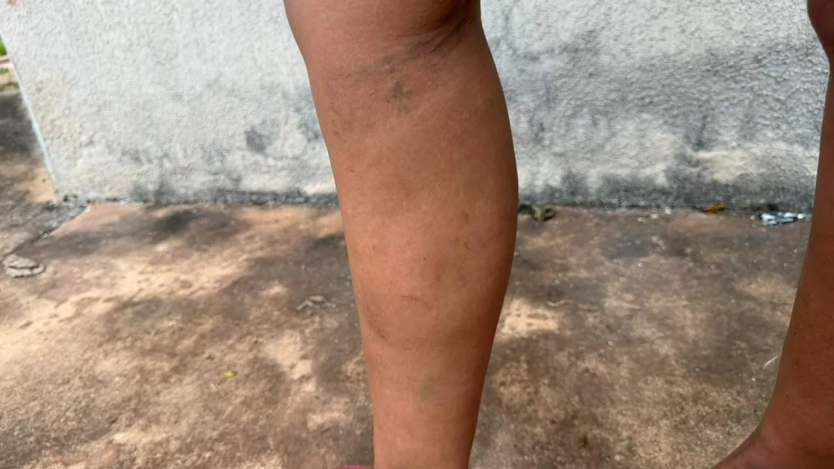 Após estupro e ameaças de morte, mulher busca socorro na Deam
