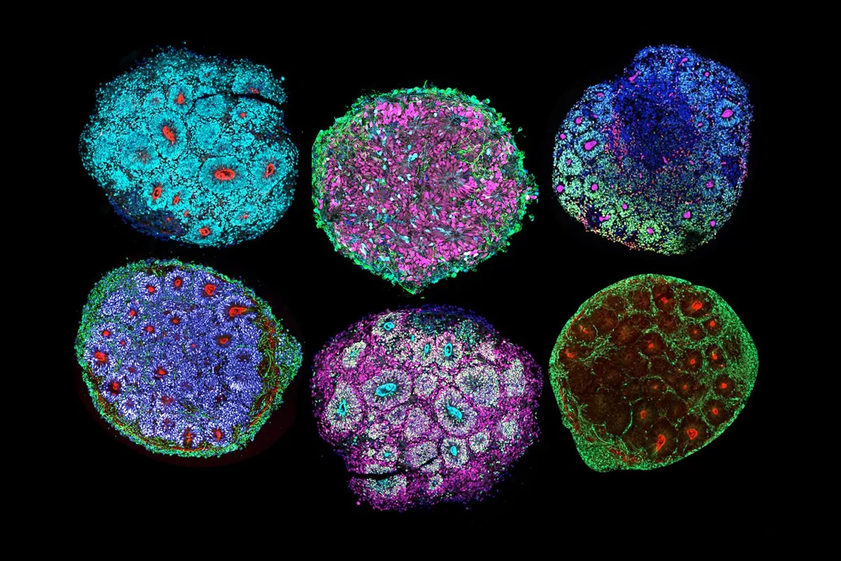 Mais antigas células cerebrais humanas de laboratório gravaram a passagem do tempo