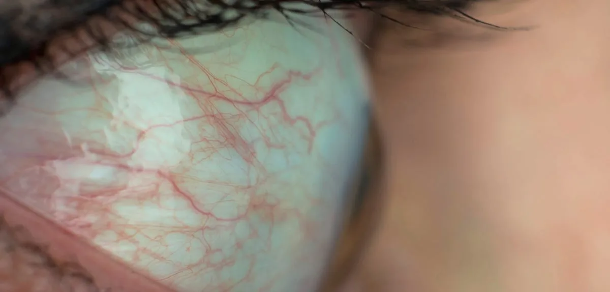 Was die Augen bereits Jahre im Voraus über die Herzgesundheit verraten