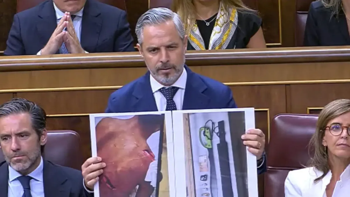 Juan Bravo muestra fotos de un herido y machetes que supuestamente utilizan los migrantes en Ceuta: "Esto es lo que llevan"